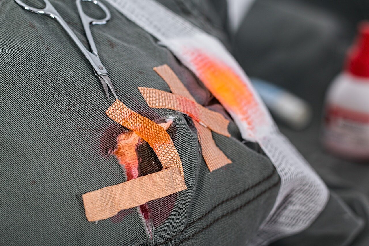 Wound packing